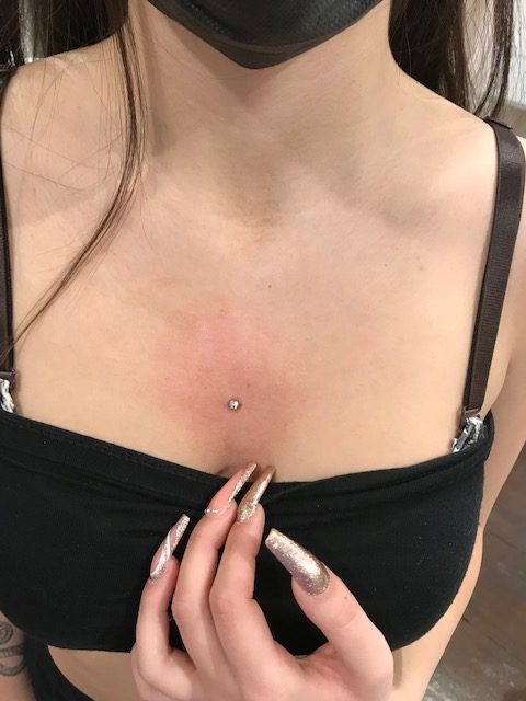 surface e microdermal